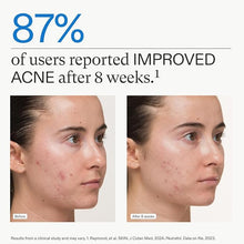Load image into Gallery viewer, NUTRAFOL Clear Skin ProPack (3 Pack/ 3 Month Supply)