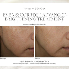 Load image into Gallery viewer, Even & Correct Advanced Brightening Treatment