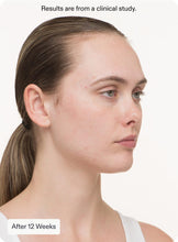 Load image into Gallery viewer, NUTRAFOL Clear Skin ProPack (3 Pack/ 3 Month Supply)
