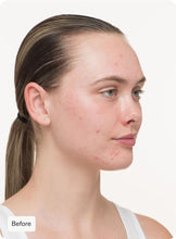 Load image into Gallery viewer, NUTRAFOL Clear Skin ProPack (3 Pack/ 3 Month Supply)
