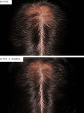 Load image into Gallery viewer, Nutrafol Hair Regrowth Men (3 Pack/3 Month Supply)