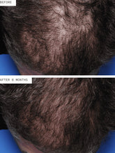 Load image into Gallery viewer, Nutrafol Hair Regrowth Men (3 Pack/3 Month Supply)