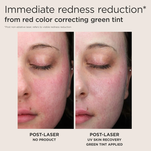 NEW! EltaMD UV Skin Recovery Red Color Correcting GREEN Tint Broad Spectrum SPF 50