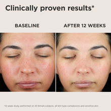 Load image into Gallery viewer, NEW! EltaMD UV Skin Recovery Red Color Correcting GREEN Tint Broad Spectrum SPF 50
