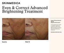 Load image into Gallery viewer, Even &amp; Correct Advanced Brightening Treatment
