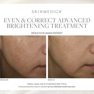 Even & Correct Advanced Brightening Treatment