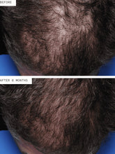 Load image into Gallery viewer, Nutrafol Hair Regrowth Men (3 Pack/3 Month Supply)
